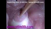 หนังผู้ใหญ่ ร้อน Cum ใส่ใน Cervix กว้างยืดหี Speculum ฟรี