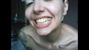 คลิปxxx Chantal apos s teeth fall apart comma rotten and black 3gp ล่าสุด