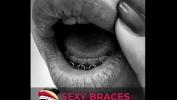 คลิปโป๊ Cute Girls With Braces Showing their smile excl 3gp ล่าสุด