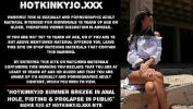 หนัง18 Hotkinkyjo summer brezee in anal hole comma fisting amp prolapse in public ล่าสุด 2024