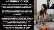 หนังav Hotkinkyjo 99cm deep dildo anal penetration comma prolapse amp more