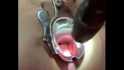 คลิปโป๊ออนไลน์ Vaginal speculum in the ass Mp4 ฟรี