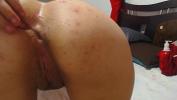 ดูหนังxxx pimples on ass Mp4