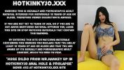 คริปโป๊ Extreme huge dildo from mr period Hankey up in Hotkinkyjo anal hole amp prolapse Mp4