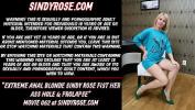 ดูหนังav Extreme anal blonde Sindy Rose fist her ass hole amp prolapse Mp4 ล่าสุด