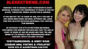 คริปโป๊ Dirtygardengirl amp Sindy Rose lesbian anal fisting and prolapse extreme Mp4