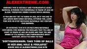 ดูหนังโป๊ Dirtygardengirl take tons of balls in her anal hole amp prolapse 3gp ฟรี