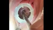 ดูหนังxxx Watch 8mm electrosound puckering my cervix as I squeal from 3gp ฟรี