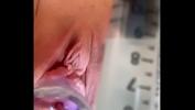 คลิปโป๊ออนไลน์ as cervix painfully dilated w catheter Mp4