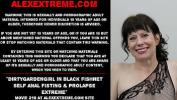 หนังxxx Dirtygardengirl in black fishnet self anal fisting amp prolapse extreme ล่าสุด 2024