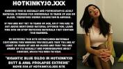 คลิปโป๊ฟรี Gigantic blue dildo in Hotkinkyjo butt amp anal prolapse extreme ร้อน 2024