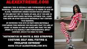 หนัง18 Hotkinkyjo in white amp red stripped costume self anal fisting amp prolapse extreme